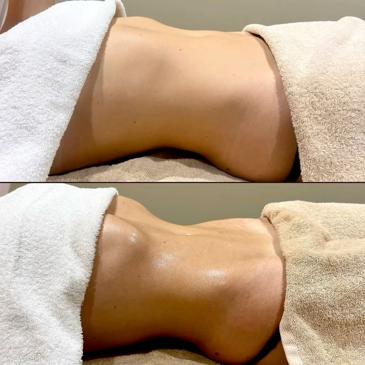 Slimming Massage